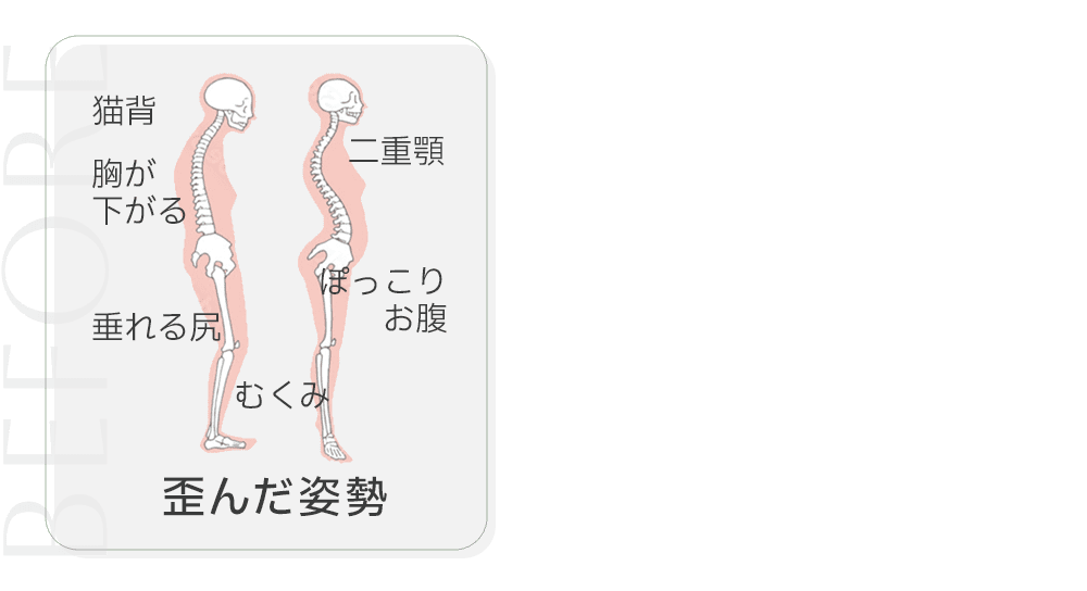 歪んだ姿勢